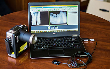 Image-Vet™ FleXX Portable Intraoral X-Ray System